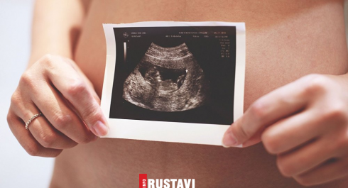 იგეგმება თუ არა კანონში ცვლილებები